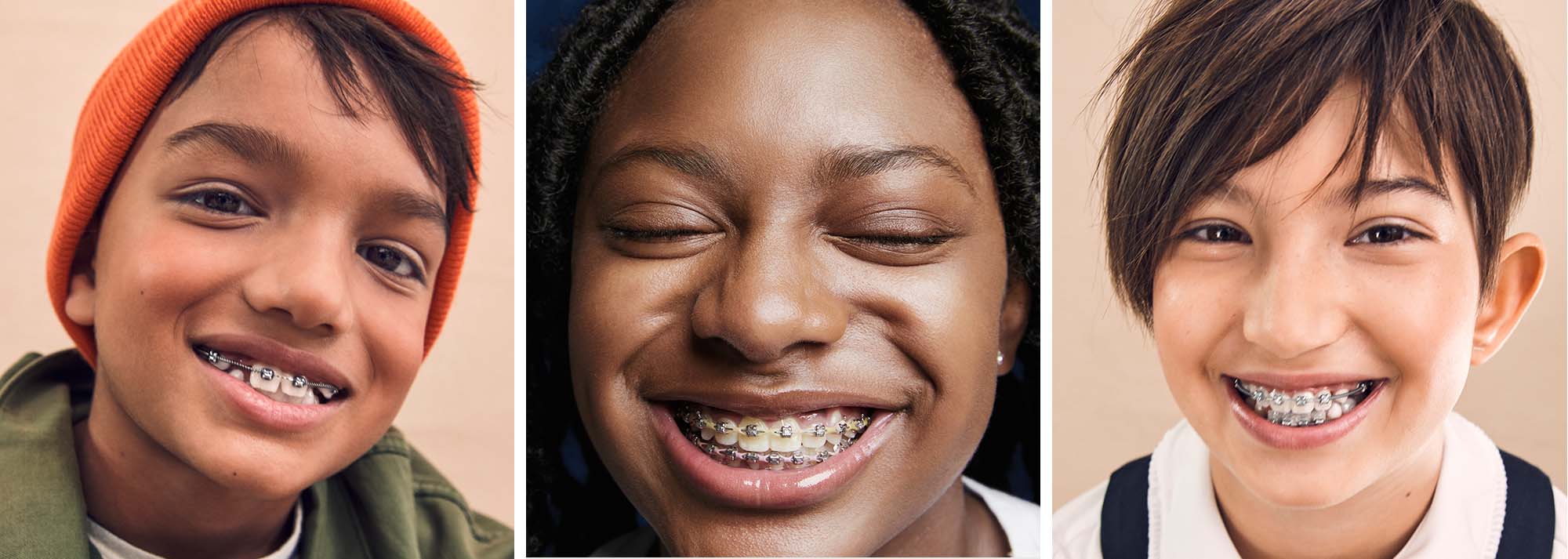 Metal braces orthodontic treatment offered by Smile Doctors