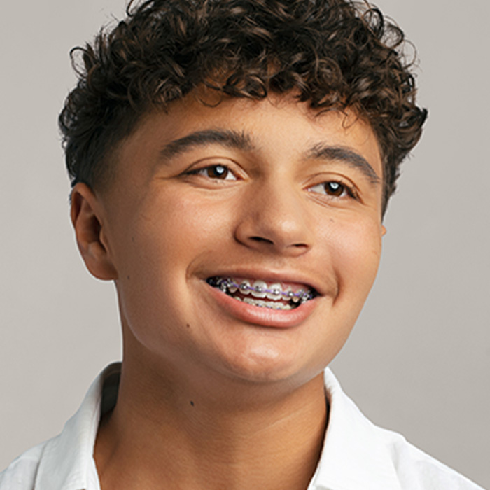 Traditional Metal Braces