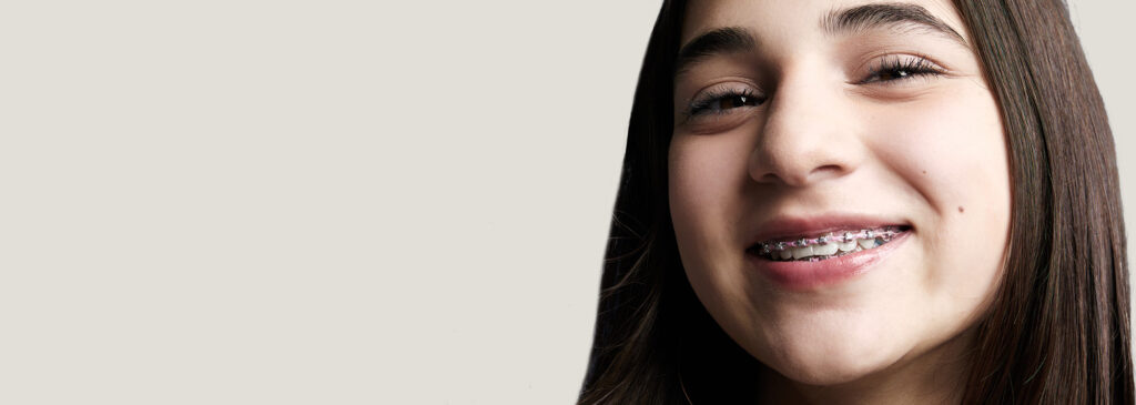 Braces by Smile Doctors orthodontists