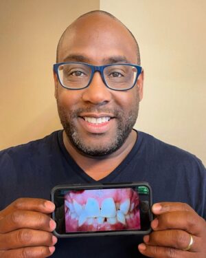 Smiling male patient post orthodontic treatment holding scan of original bite and alignment
